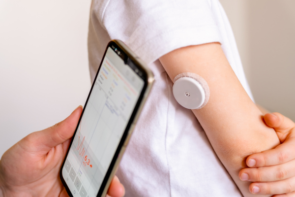 Glucose Monitor
